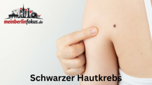 thrombozyten erhöht schwarzer hautkrebs